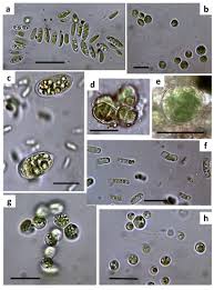 Attēlu rezultāti vaicājumam “Comatricha elegans var. microspora macro”