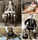 Incredible Human Conditions: 10 Head-Turning Medical Oddities ...