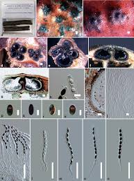Attēlu rezultāti vaicājumam “Rosellinia desmazieri spores”