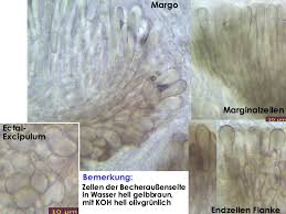 Attēlu rezultāti vaicājumam “Mollisia amenticola”