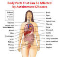 Autoimmune diseases fact sheet | womenshealth.