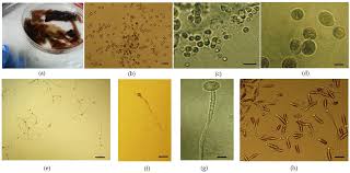 Attēlu rezultāti vaicājumam “Collaria rubens spores”