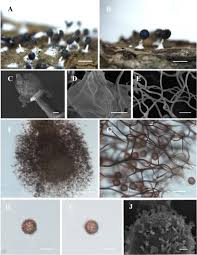 Attēlu rezultāti vaicājumam “Diachea muscorum spores”