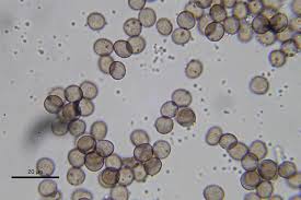 Attēlu rezultāti vaicājumam “Fuligo candida f. persicum macro”