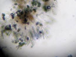 Attēlu rezultāti vaicājumam “Calicium salicinum”