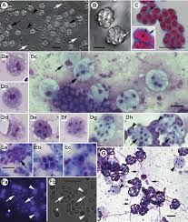 Attēlu rezultāti vaicājumam “Enteridium liceoides spores”