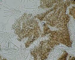 Attēlu rezultāti vaicājumam “Mollisia cinerea”