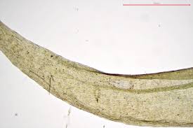 Attēlu rezultāti vaicājumam “Warnstorfia fluitans”