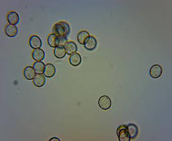 Attēlu rezultāti vaicājumam “Arcyria incarnata spores”