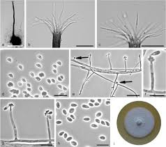 Attēlu rezultāti vaicājumam “Schistidium robustum sporophyte”