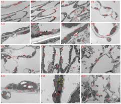 Attēlu rezultāti vaicājumam “Coleosporium sp.”