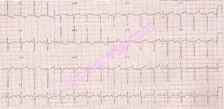 Image result for  ^ L V [ h    