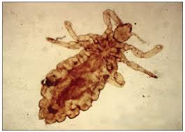 Attēlu rezultāti vaicājumam “Pediculus humanus capitis”