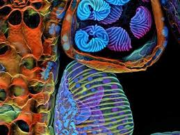 Attēlu rezultāti vaicājumam “Heterotrichia pomiformis (syn. Arcyria pomiformis) spores”