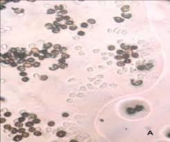 Attēlu rezultāti vaicājumam “Hemitrichia serpula spores”