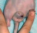 the Rat Report
