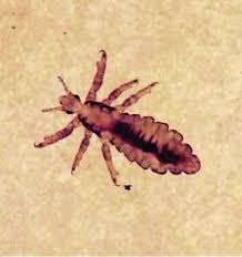 Attēlu rezultāti vaicājumam “Pediculus humanus capitis”