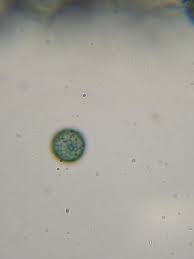 Attēlu rezultāti vaicājumam “Stemonitopsis hyperopta var. landewaldii spores”