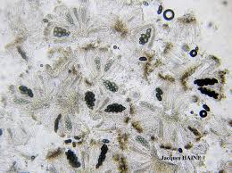 Attēlu rezultāti vaicājumam “Anaptychia ciliaris”