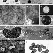 Attēlu rezultāti vaicājumam “Didymium annulisporum”