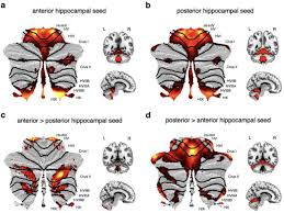 Image result for Cambridge N C I Cc