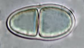 Attēlu rezultāti vaicājumam “Megalaria grossa”