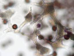 Attēlu rezultāti vaicājumam “Badhamia melanospora macro”