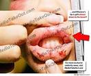 Rihanna Beat Up   Brutal Abuse Photos TMZ