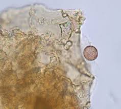 Attēlu rezultāti vaicājumam “Perichaena depressa spores”