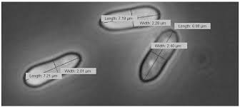 Attēlu rezultāti vaicājumam “Craterium minutum cf. var. brunneum spores”