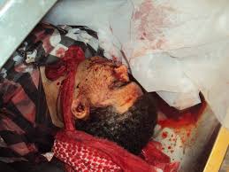 نظام المجرم معمر القذافي يقتل شعبه تشبثا بالحكم Images?q=tbn:ANd9GcTitHtirSl4IXJRlKD1kxqJxV__E0Iv6LvR15In9w28jl3pJCo5