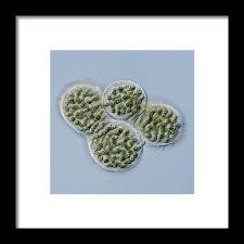 Attēlu rezultāti vaicājumam “Nostoc pruniforme cells”