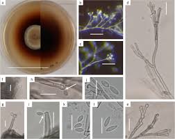 Attēlu rezultāti vaicājumam “Biscogniauxia marginata”
