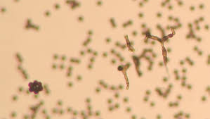 Attēlu rezultāti vaicājumam “Badhamia lilacina spores”