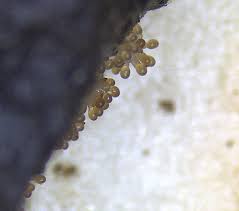 Attēlu rezultāti vaicājumam “Arcyria globosa spores”
