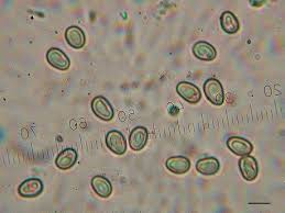Attēlu rezultāti vaicājumam “Lycogala botrydium spores”