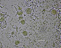 Attēlu rezultāti vaicājumam “Chaenotheca chlorella”