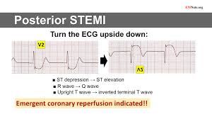 Image result for  v    q
