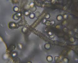 Attēlu rezultāti vaicājumam “Arcyria cinerea spores”