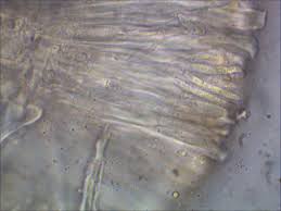 Attēlu rezultāti vaicājumam “Biatora sphaeroides”