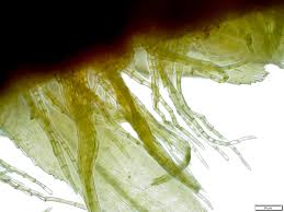 Attēlu rezultāti vaicājumam “Palustriella falcata”