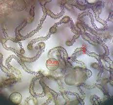 Attēlu rezultāti vaicājumam “Lycogala ustulatum sessile”