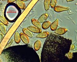 Attēlu rezultāti vaicājumam “Tranzschelia pruni-spinosae spores”