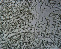 Attēlu rezultāti vaicājumam “Nostoc commune cells”