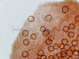 Attēlu rezultāti vaicājumam “Trichia erecta”