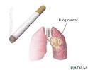 smoking