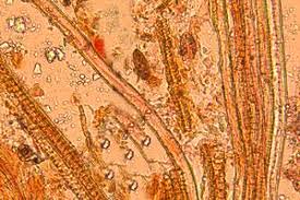 Attēlu rezultāti vaicājumam “Diderma chondrioderma sessile”
