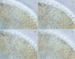 Attēlu rezultāti vaicājumam “Diderma montanum spores”
