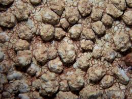 Attēlu rezultāti vaicājumam “Pertusaria flavida”