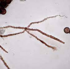 Attēlu rezultāti vaicājumam “Diderma deplanatum”